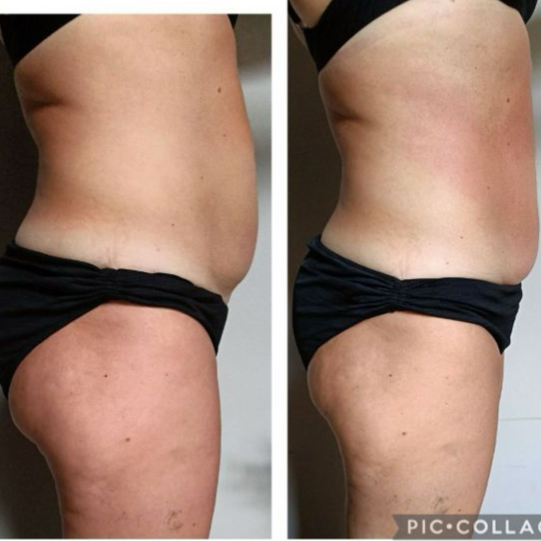 Санжарио тела