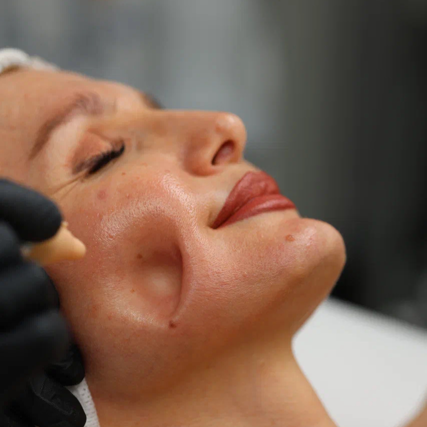 АКЦИЯ SKINHALE комплексное омоложение , 50% на первый визит 🎀