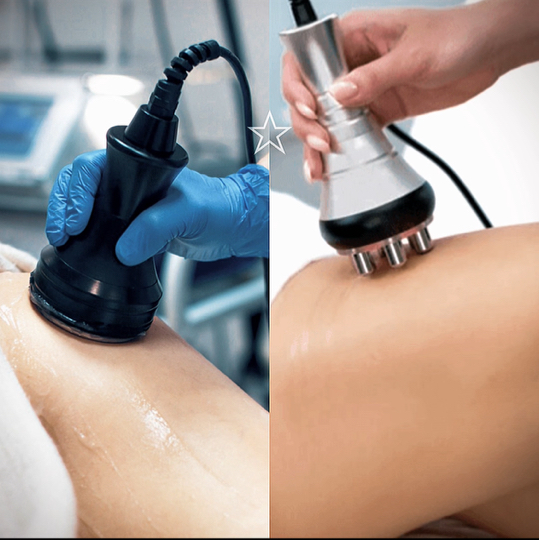 Кавитация + RF