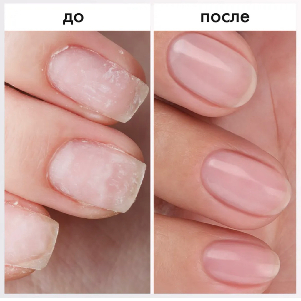 Восстановление ногтей