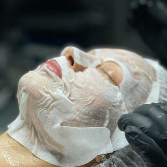 карбокситерапия