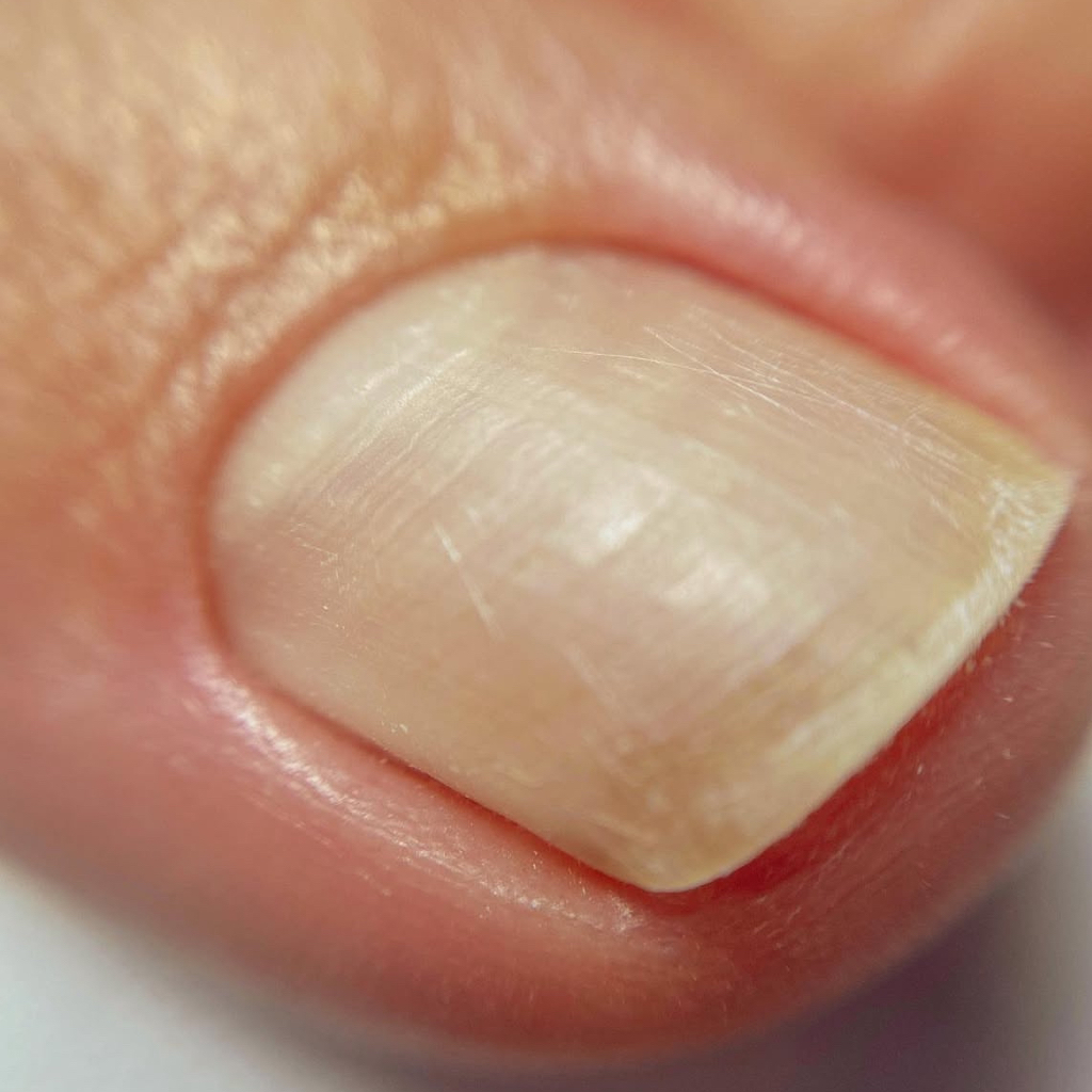 Гигиенический женский педикюр