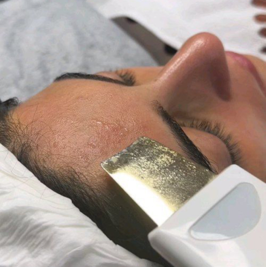 Ультразвуковая чистка