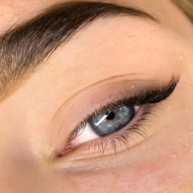 Наращивание уголков