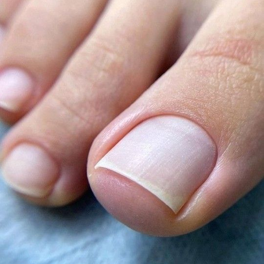 Педикюр гигиенический (только пальчики)