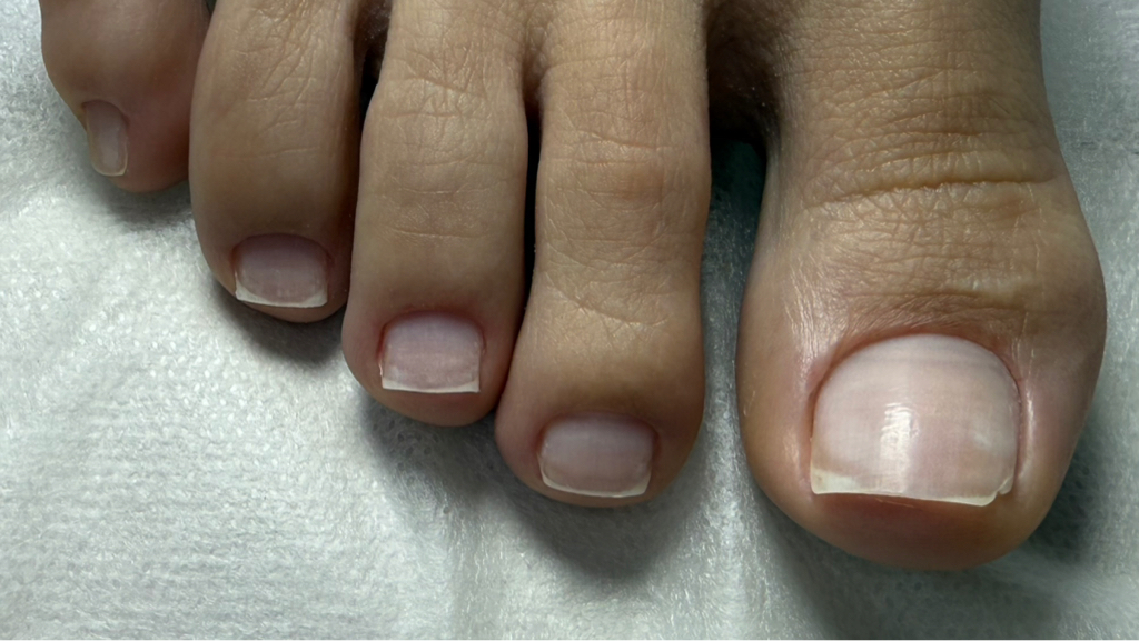 Педикюр гигиенический