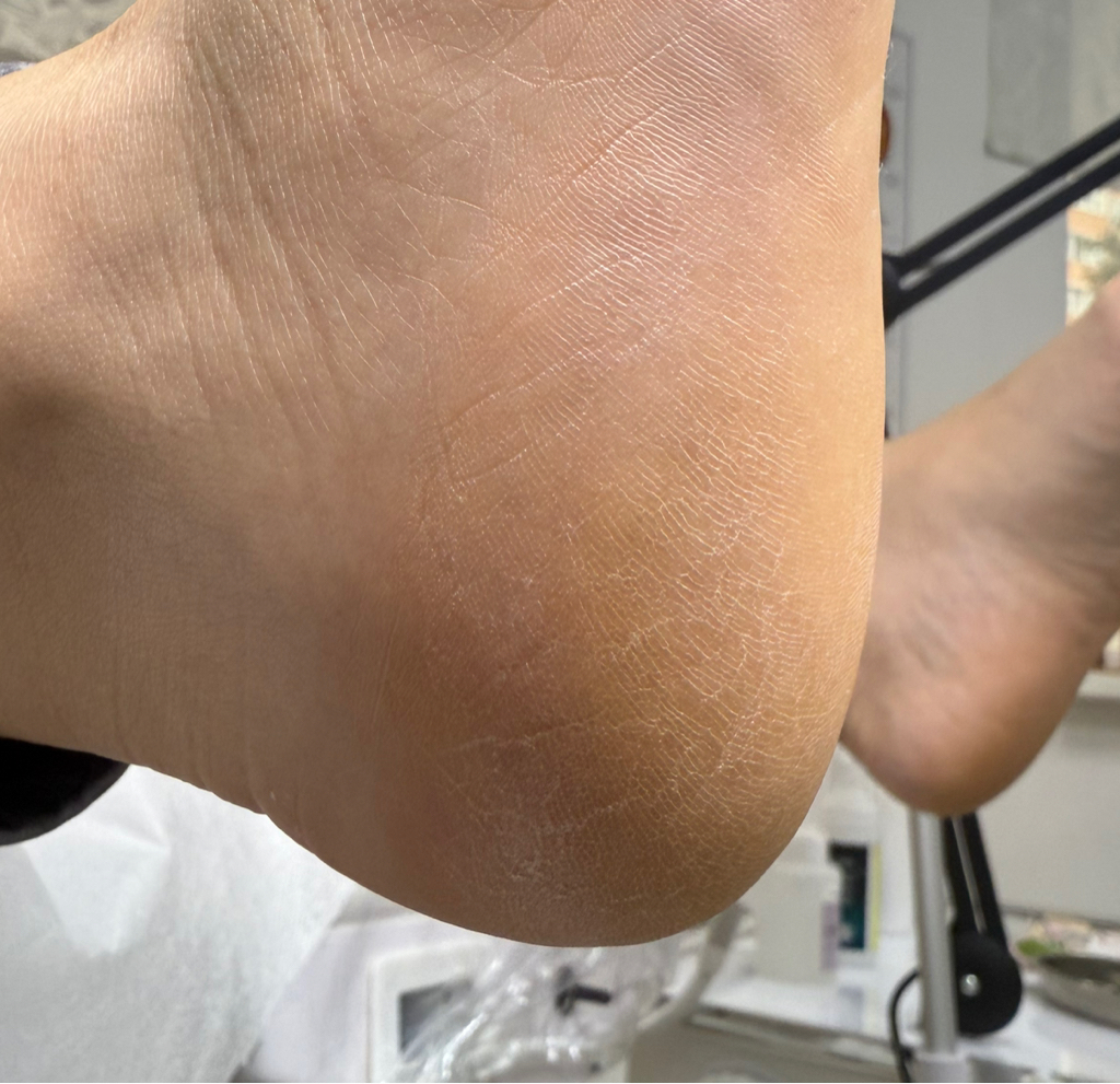 Обработка стоп  без изменений