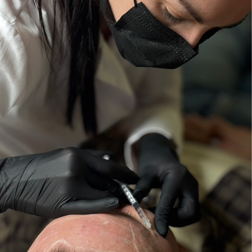 Ботулинотерапия