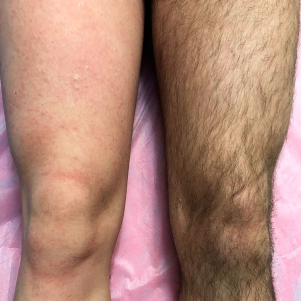 ноги полностью