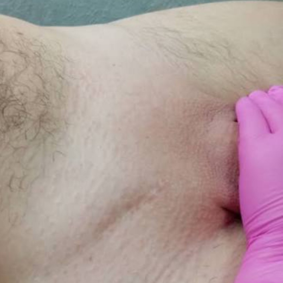 глубокое бикини