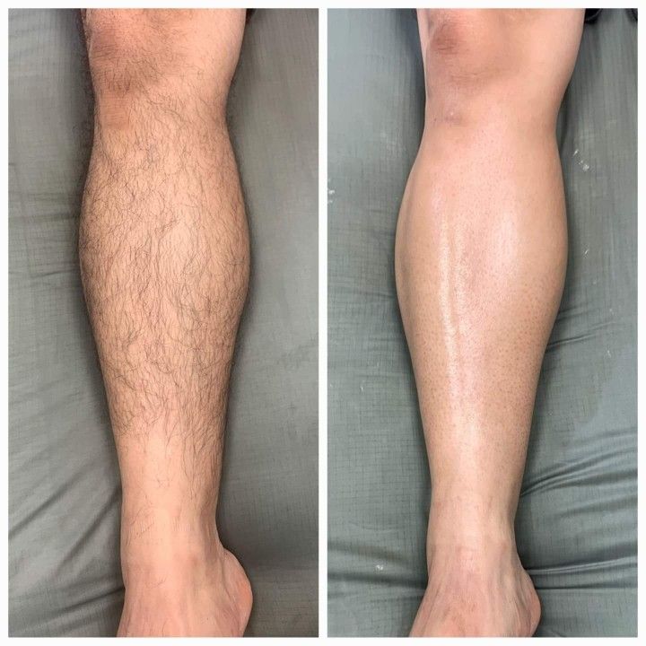 голени + колено