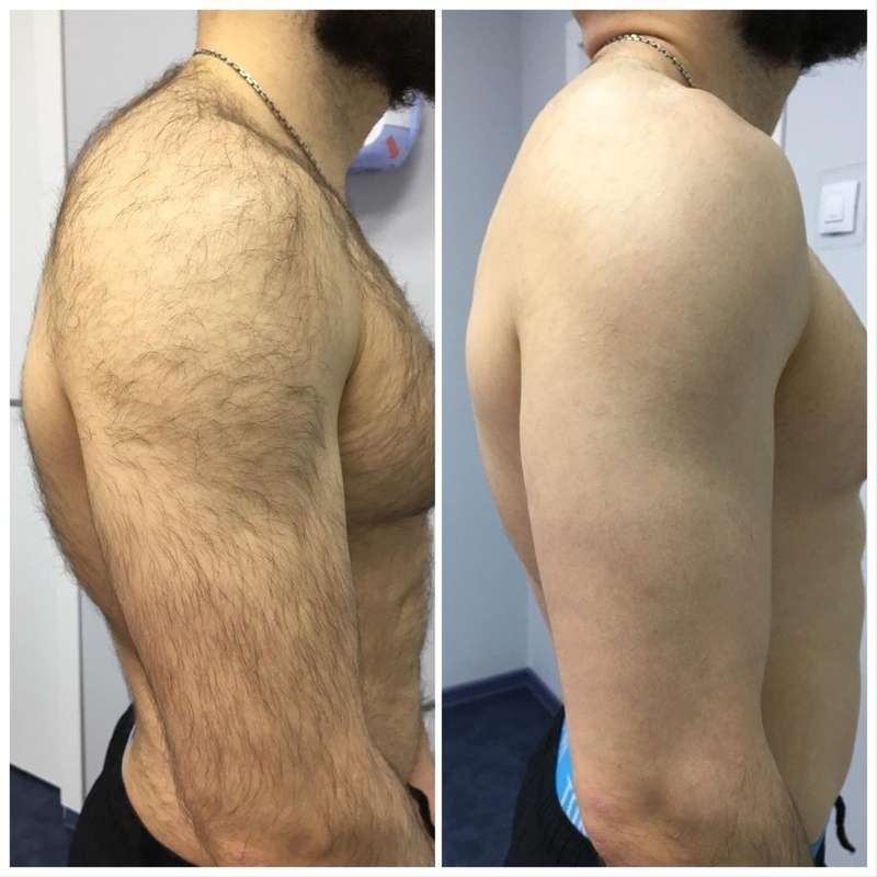 руки полностью