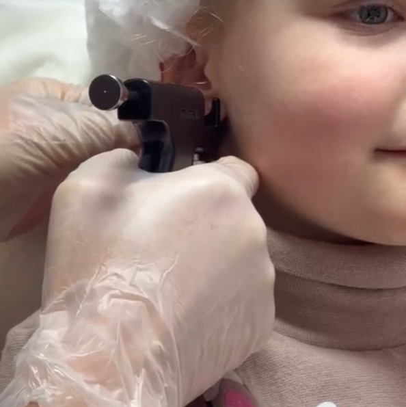 Прокол ушей