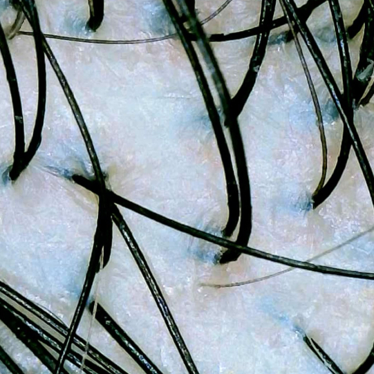 Глубокое очищение кожи коровы по типу кожи