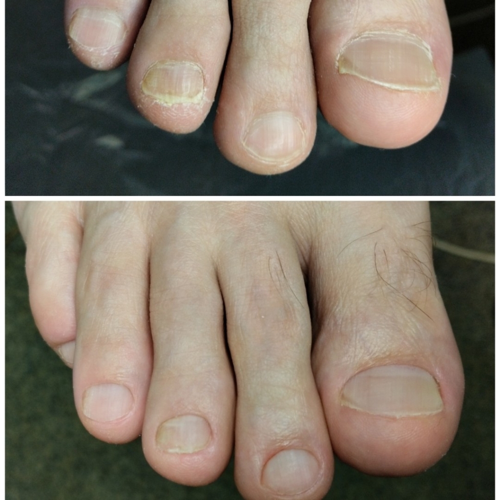 Мужской педикюр (пальчики)