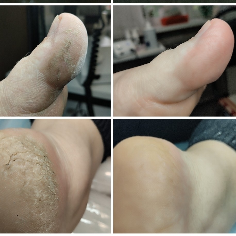 Полный педикюр без покрытия