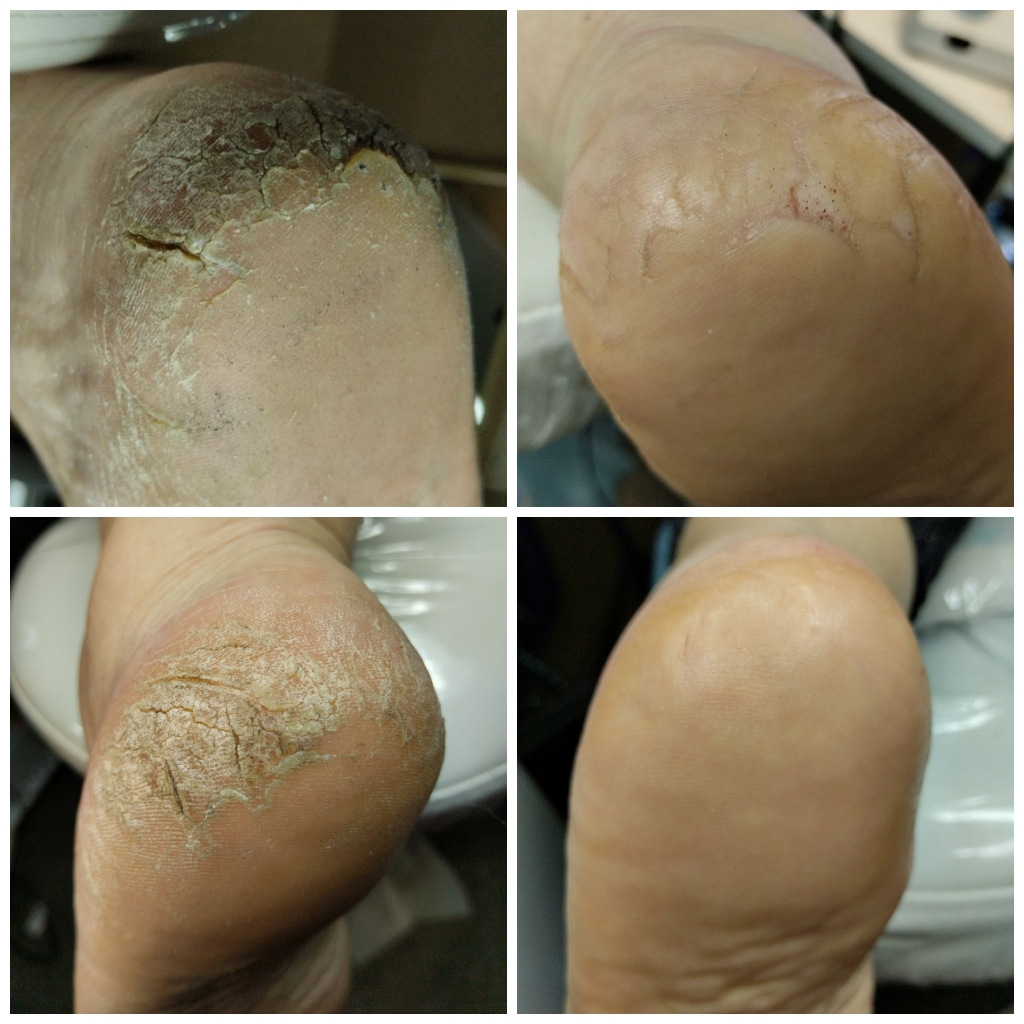 Сложные ножки