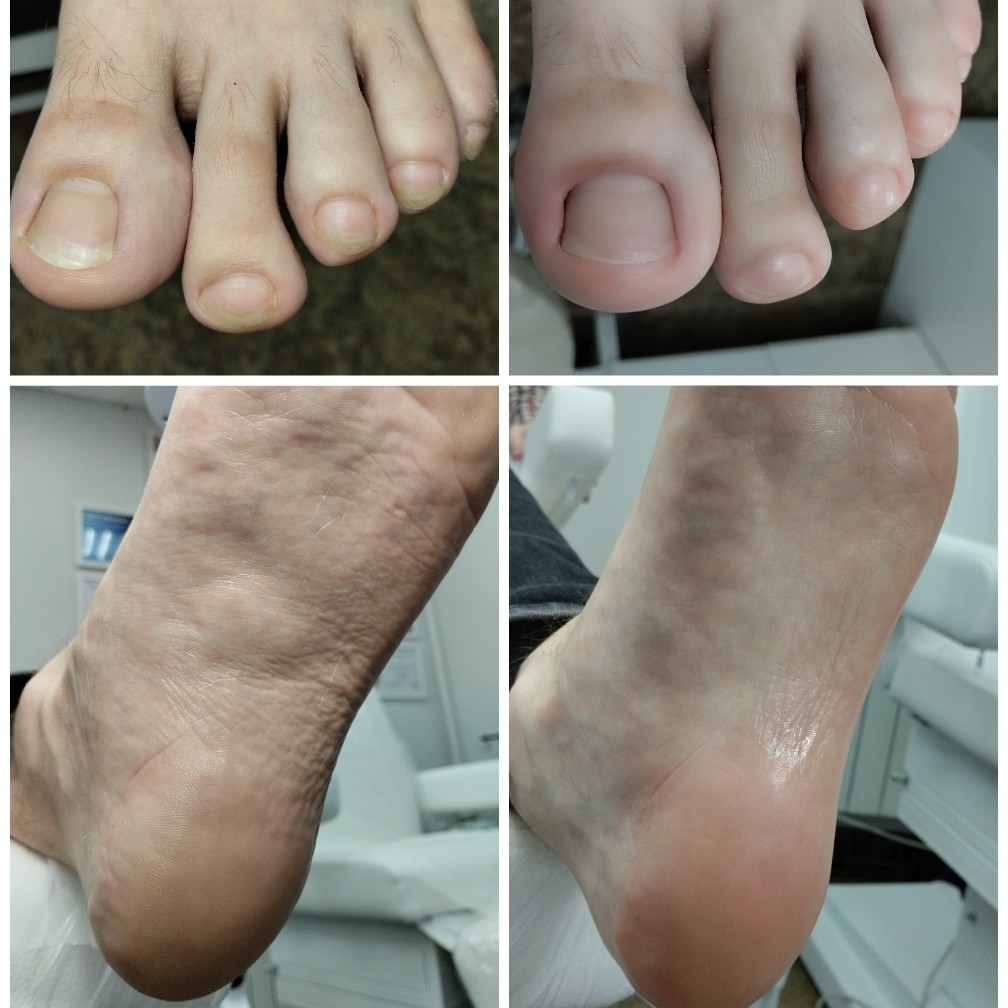 Мужской педикюр полный (пальчики/стопы)