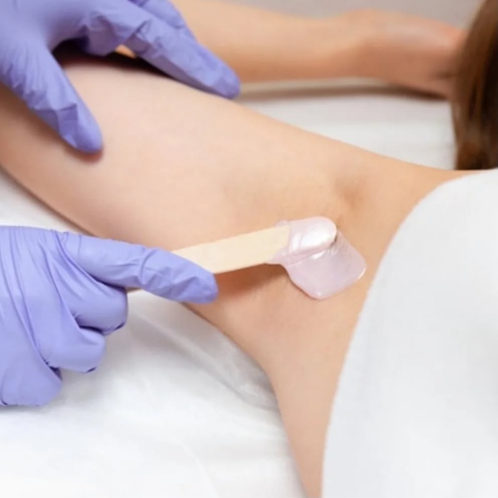 Депиляция зоны подмышечных впадин