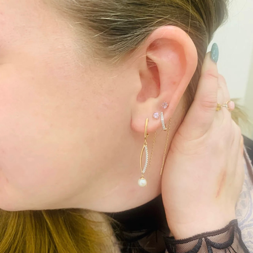 Пирсинг мочки катетером