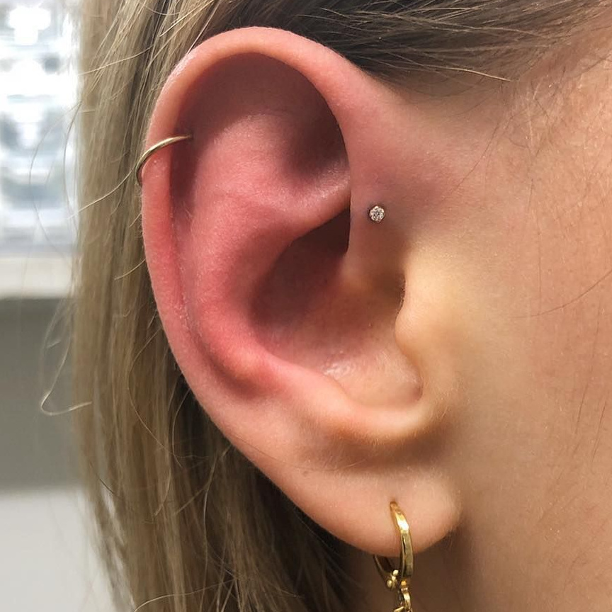 Форвард хеликс