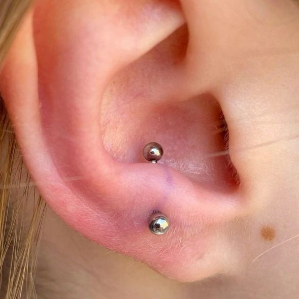 Анти-трагус