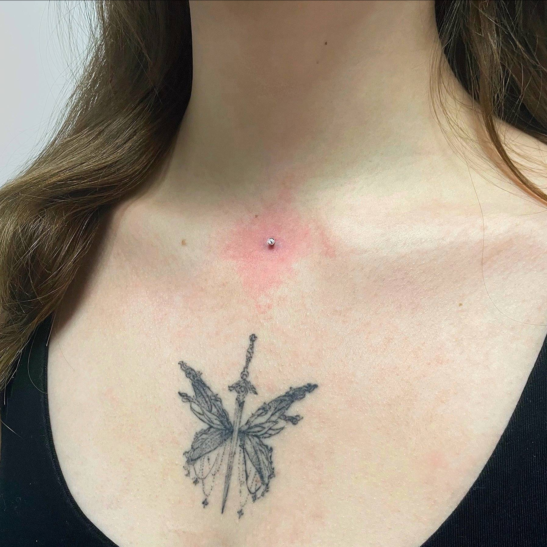 Микродермал