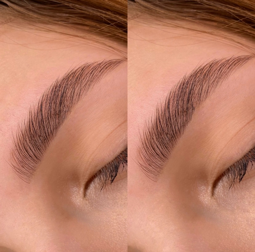 Ботокс/счастье для бровей