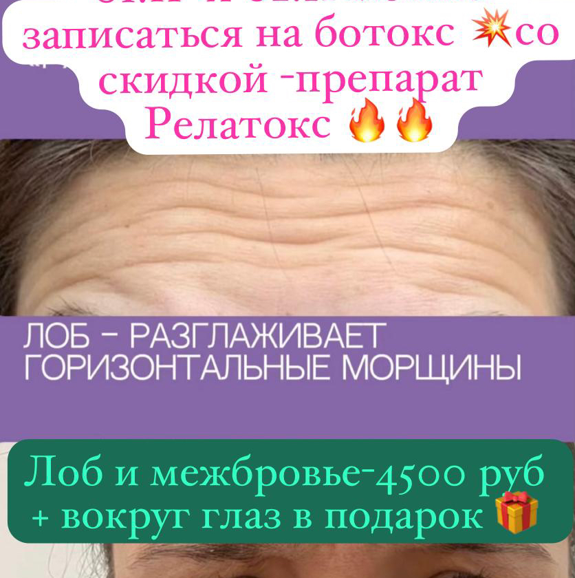 Ботокс Релатокс