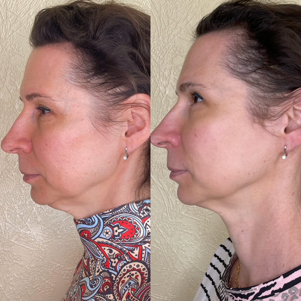 Микротоковая терапия (курс 10 сеансов)