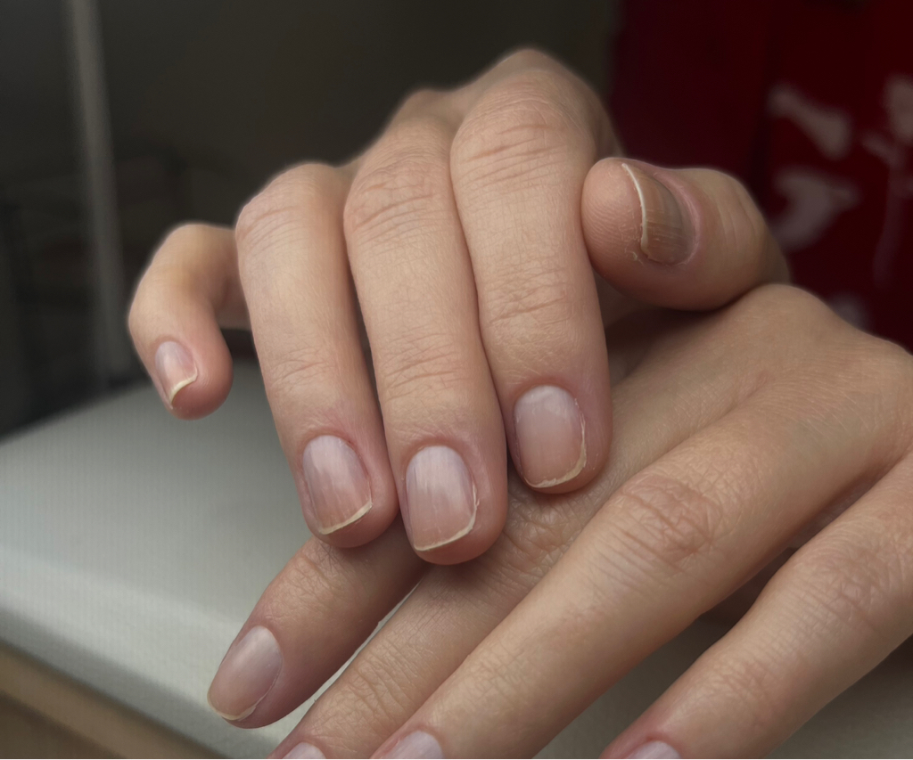 парафинотерапия рук