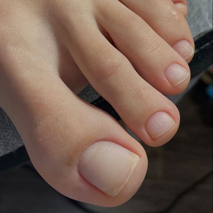 Обработка пальцев ног