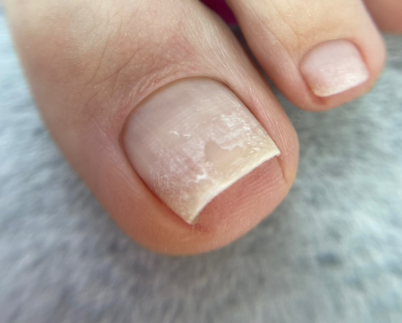 Педикюр/обработка пальчиков без покрытия