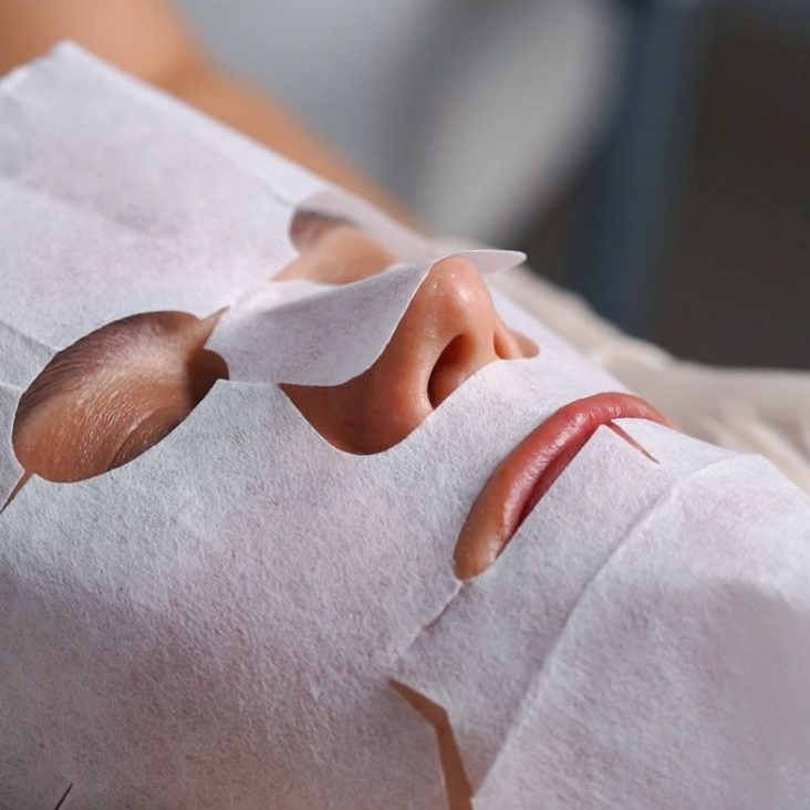 Карбокситерапия