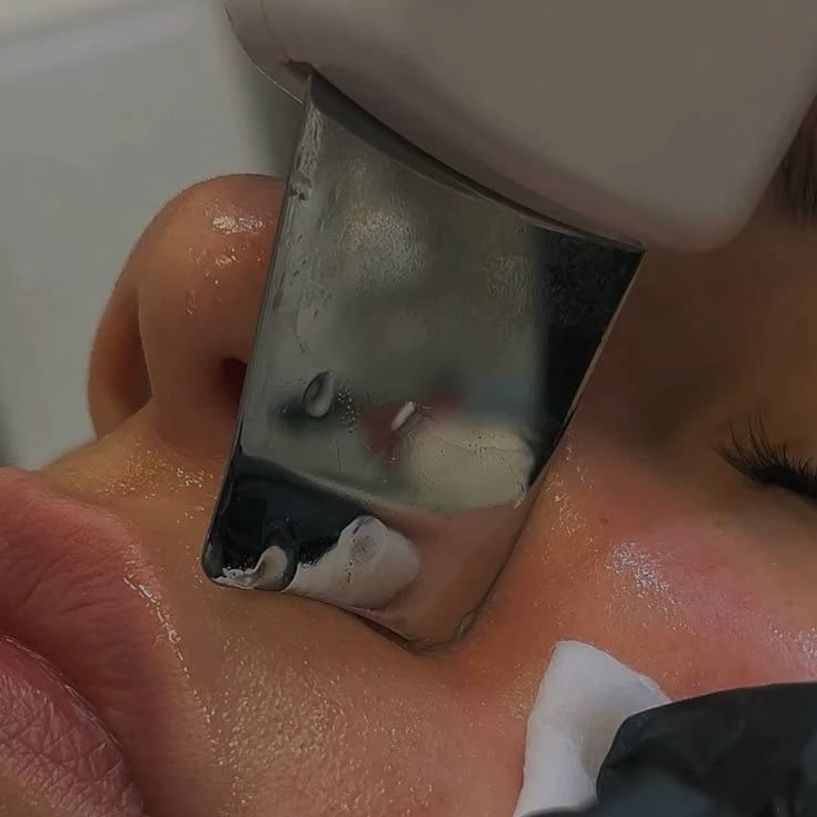 Ультразвуковая чистка лица