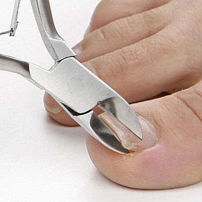 Подстригание ногтей