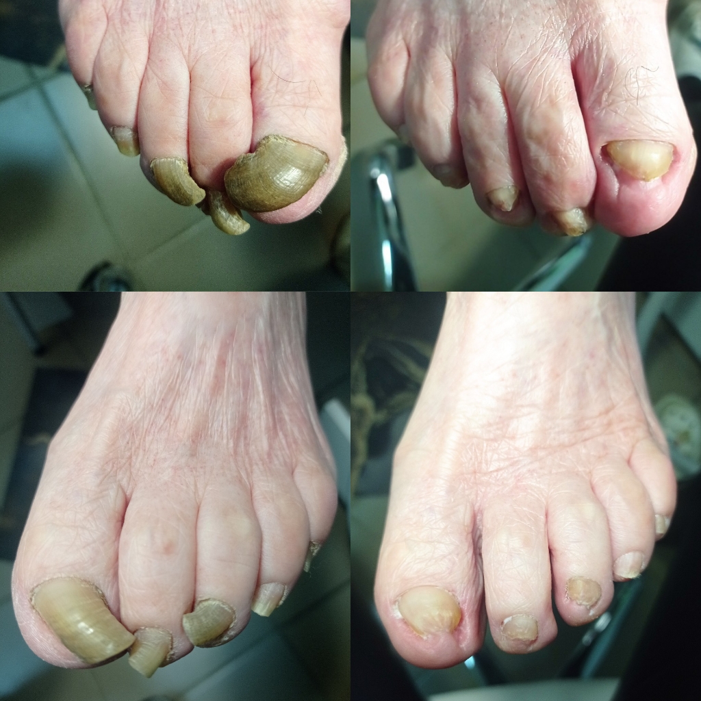 Выезд на дом по г. Алексин