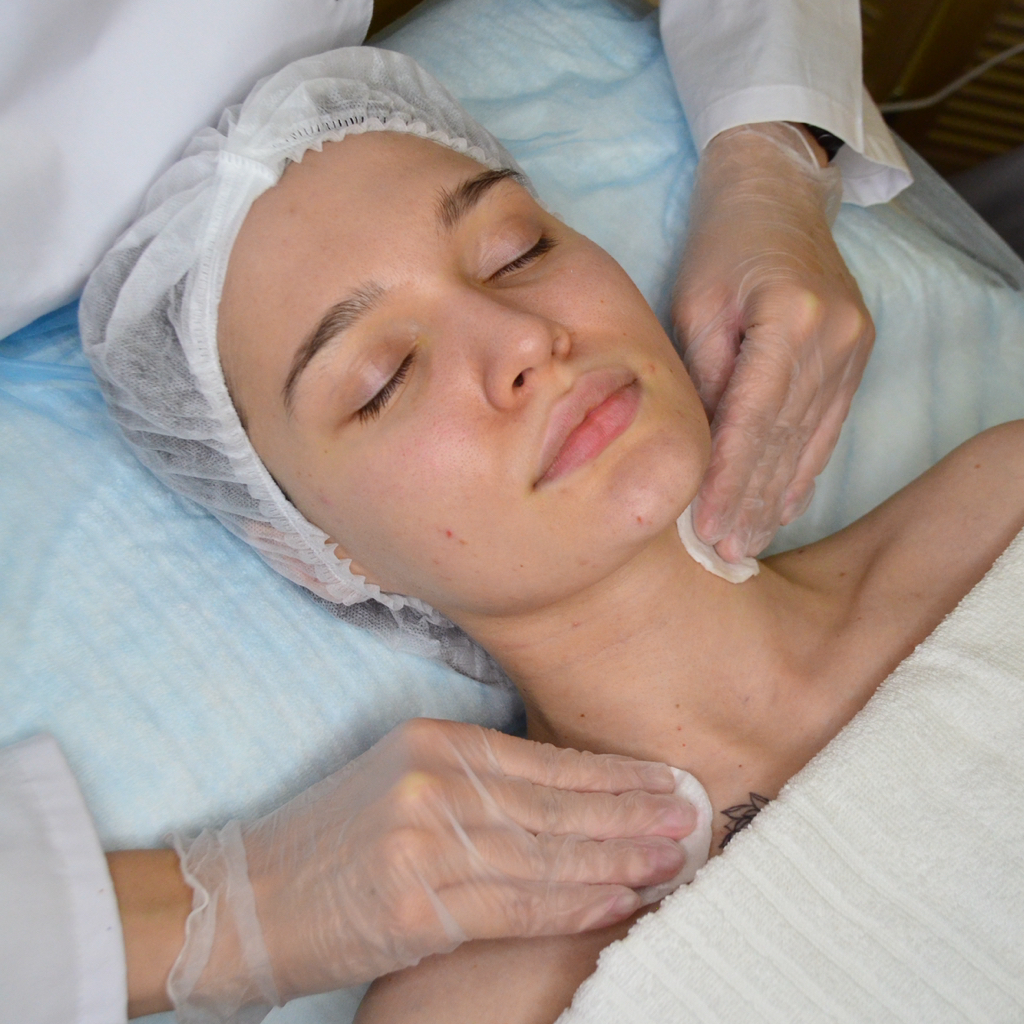 Поверхностный пилинг (азелаиновый/феруловый/гликолевый/ пировиноградный)