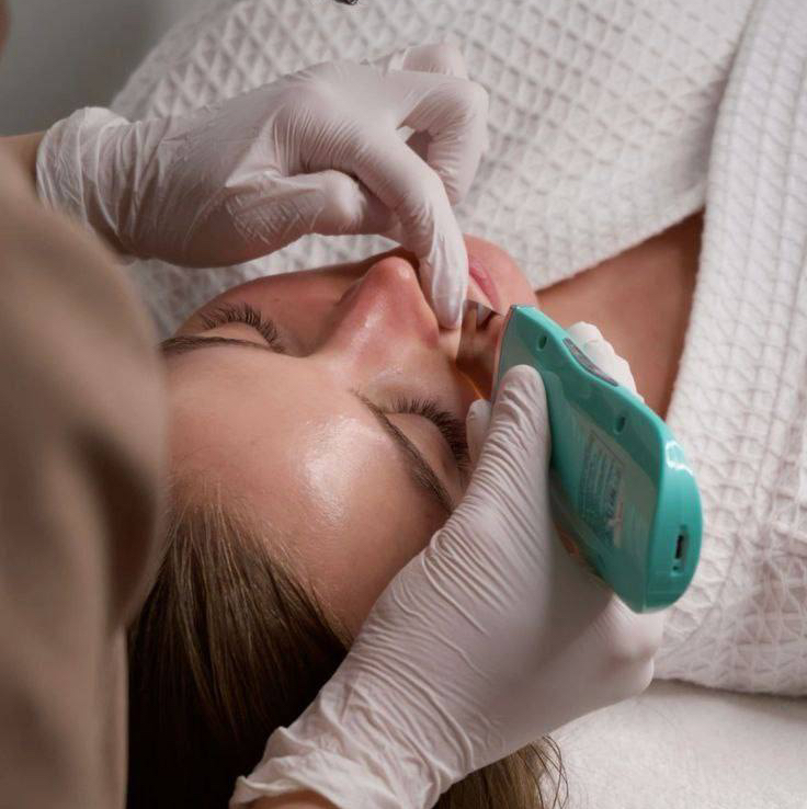 чистка лица