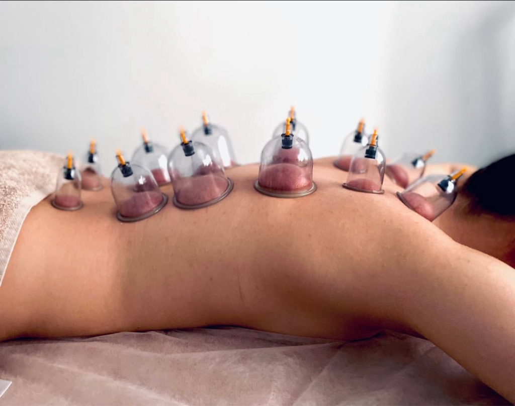 Банки лечебные