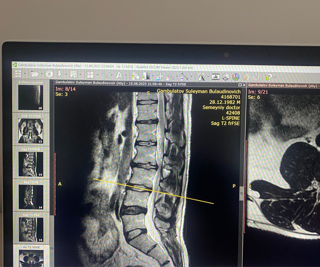Консультация