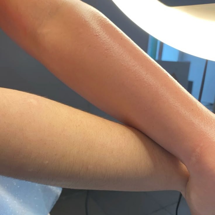 Шугаринг руки до локтя