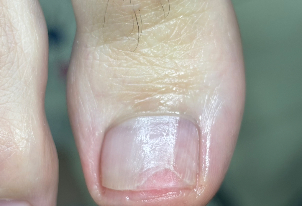 Протезирование