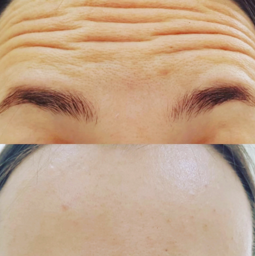 Осмотр после бта