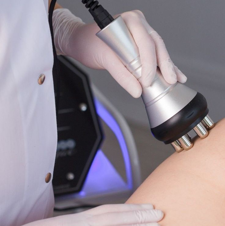 RF лифтинг тела(1 зона)