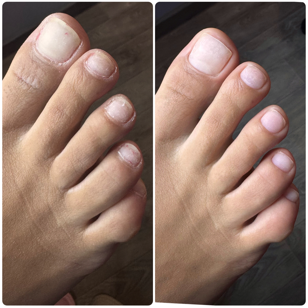 Пальчики ног без покрытия