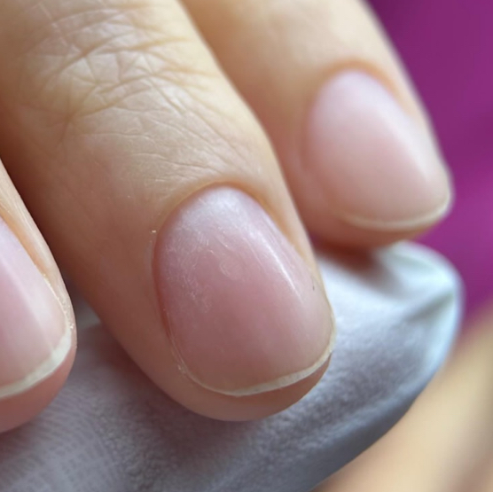 Снятие покрытия