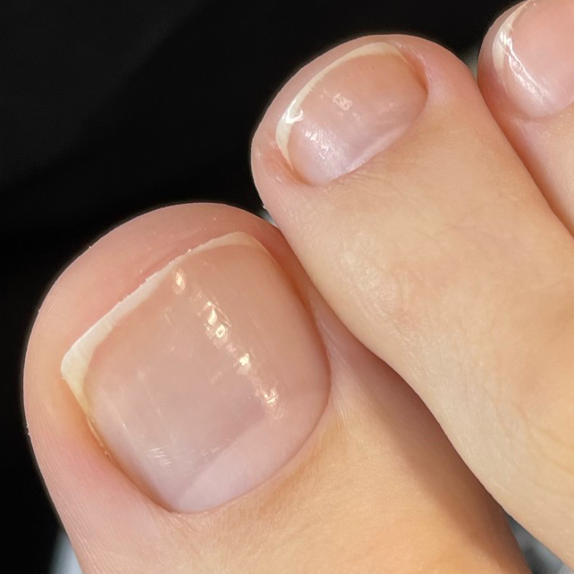 Снятие покрытия