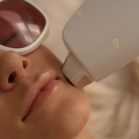 ЛЭ Над верхней губой