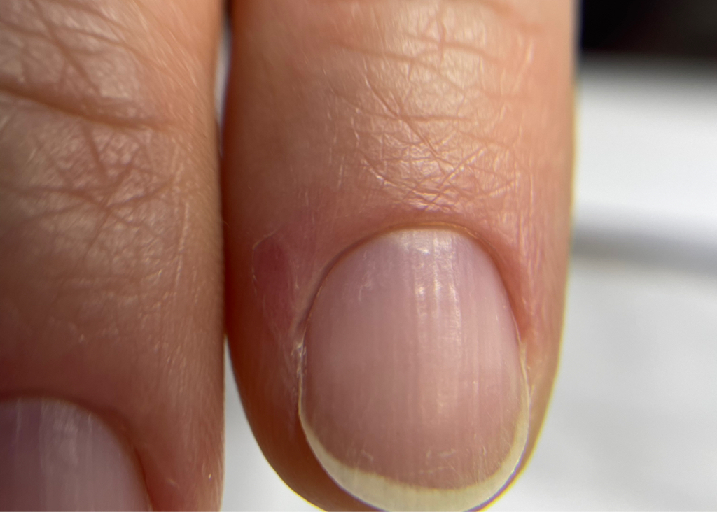 Полное снятие гель-лака